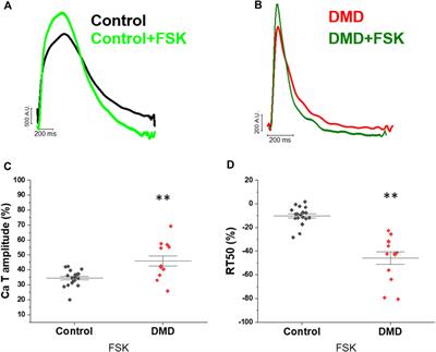 Calcium handling maturation and adaptation to increased substrate stiffness in human iPSC-derived cardiomyocytes: The impact of full-length dystrophin deficiency